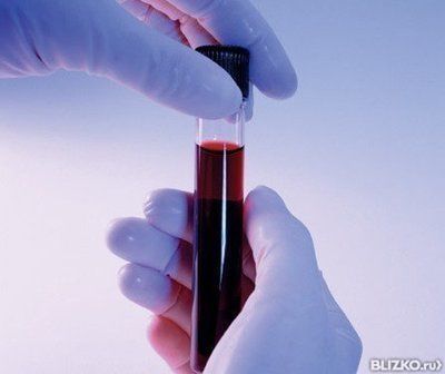 Почему при заболевании печени чешется тело
