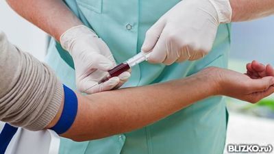 Чем лечить холестериновые бляшки на коже